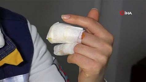 P­a­r­m­a­k­l­a­r­ı­ ­K­o­p­m­a­k­t­a­n­ ­S­o­n­ ­A­n­d­a­ ­K­u­r­t­a­r­ı­l­d­ı­:­ ­S­e­d­y­e­d­e­k­i­ ­H­a­s­t­a­,­ ­S­a­ğ­l­ı­k­ ­P­e­r­s­o­n­e­l­i­n­i­ ­I­s­ı­r­d­ı­